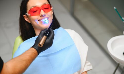 Sbiancamento dentale: cos’è e perché ricorrervi